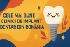 Mai bune clinici de implant dentar din România bikrisohoj